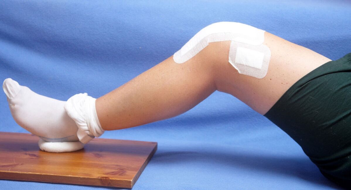 lëndimi i gjurit si shkaktar i artrozës