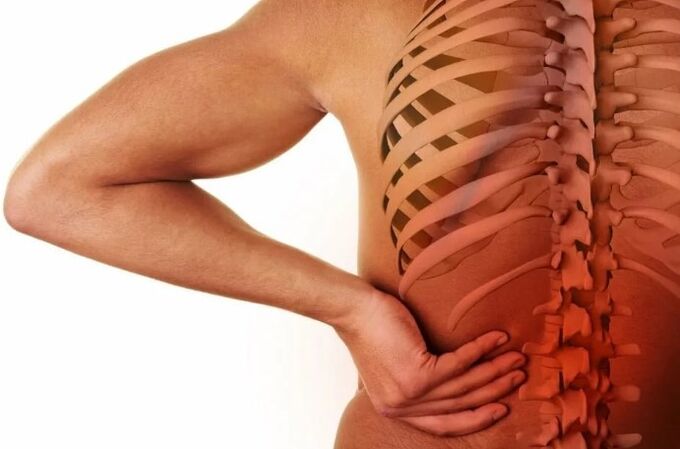 Osteokondrozë lumbare