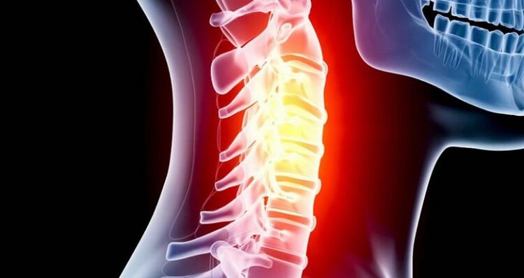 Inflamacion i rajonit të qafës së mitrës