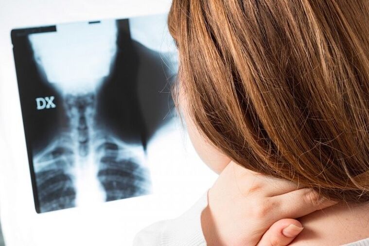 X -RAY E RREGULLIT
