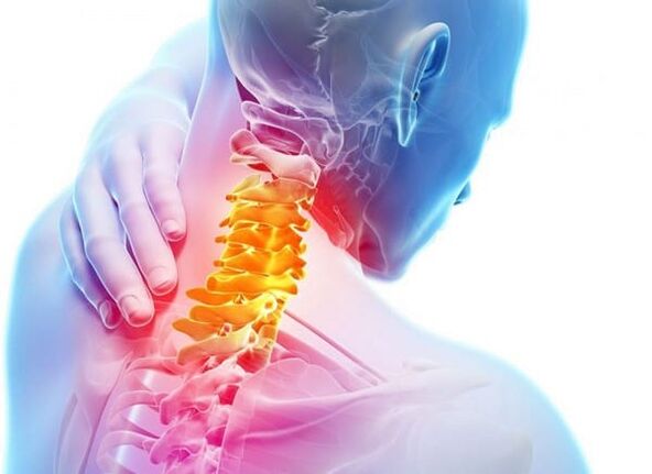 Osteokondroza e shpinës së qafës së mitrës