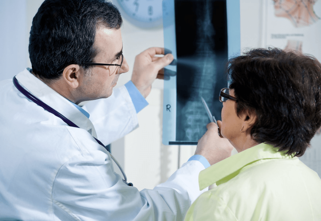 Një neurolog diagnostikon osteokondrozën duke përdorur radiografinë e shtyllës kurrizore
