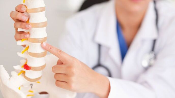 shpjegimi i osteokondrozës lumbare në një model të shtyllës kurrizore